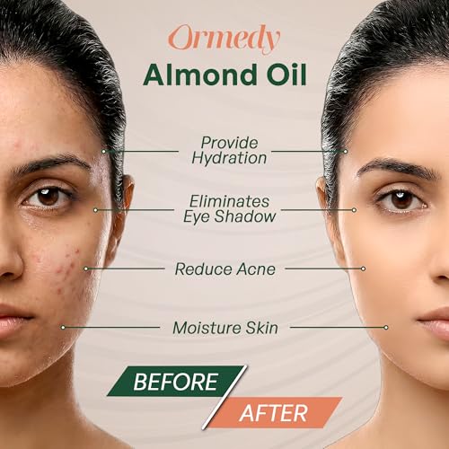 Image of 100% Pure Cold Pressed Sweet Almond Oil 30ml - Natural Unrefined Oil for Hair Growth, Skin, Face & Moisturizing