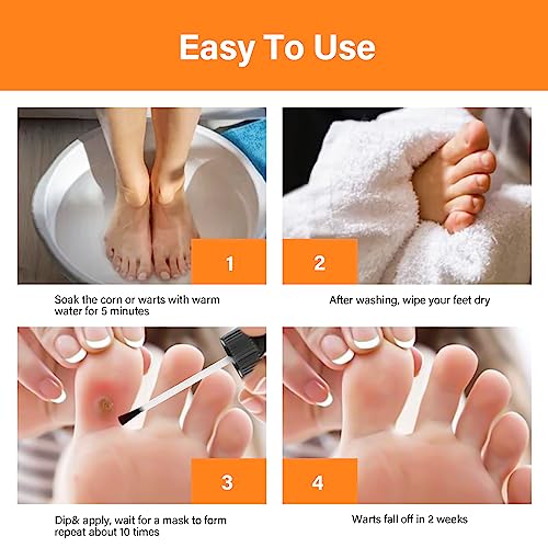 Corn Removers for Feet Extra Strength, Foot Corn Remover, Liquid Corn & Callus Remover for Toes