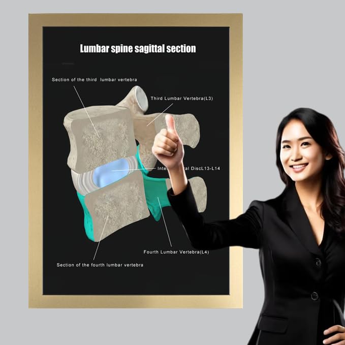 Image of Taanfu Body Educational Learning Anatomy Posters ，Lumbar Plane Art Lumbar Villi Anatomy Art Poster Digestive System Organs Illustration Small Intestine Physiology Anatomy Wall Art Villi