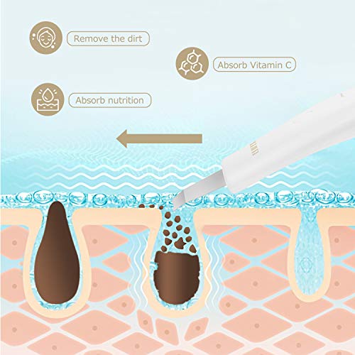 Skin Scrubber, Ultrasonic Pore Cleaner Blackhead Remover, Facial Scrubber Spatula, Comedones Extractor Rechargeable Face Lifting Tool with 3 modes for Facial Deep Cleansing - Thumbnail 5