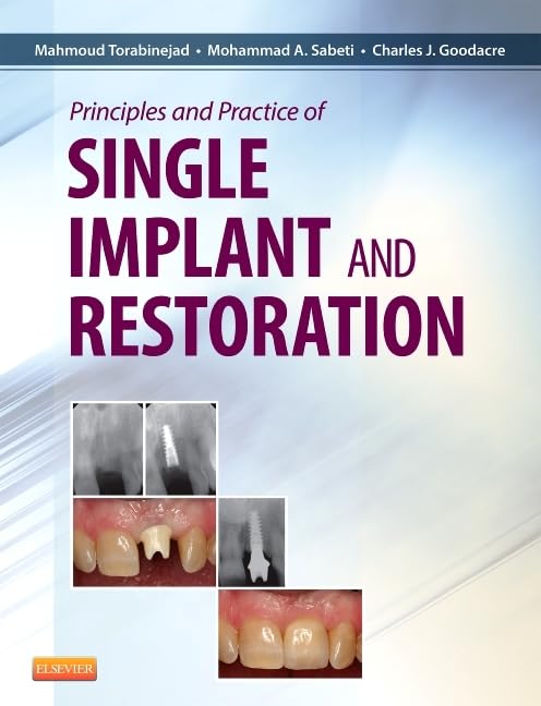 Buy Principles and Practice of Single Implant and Restoration — BookShops.in