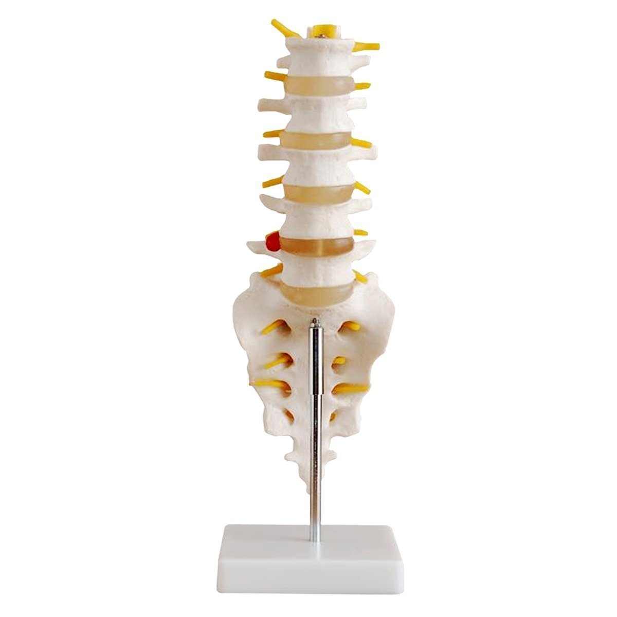 Medical Human Spine Spine Pathology Demonstration Model Anatomical Model Lumbar Vertebrae Sacrum & Coccyx, with Herniation Disc Sold by East dental