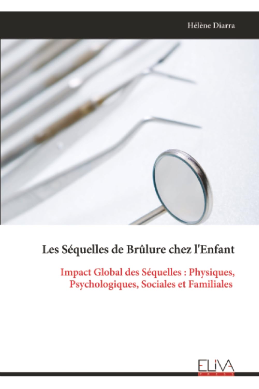 Les Séquelles de Brûlure chez l'Enfant: Impact Global des Séquelles : Physiques, Psychologiques, Sociales et Familiales