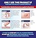Alocane Precision Freeze, Skin Tag Remover, Cryotherapy Skin Tag Home Removal Kit, FDA-Cleared, Results in 1 Treatment, with 12 Precision-tip applicators