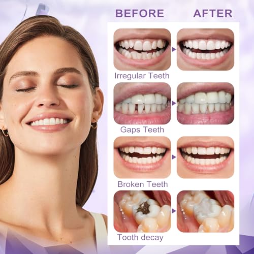 Image of Tooth Repair Kit,Moldable Beads for Teeth Repair,DIY Tooth Filling Repair Kit Fixing The Missing and Broken Replacements, DIY Natural Filling Fake Teeth,Halloween Vampire Teeth Fangs (100ML)