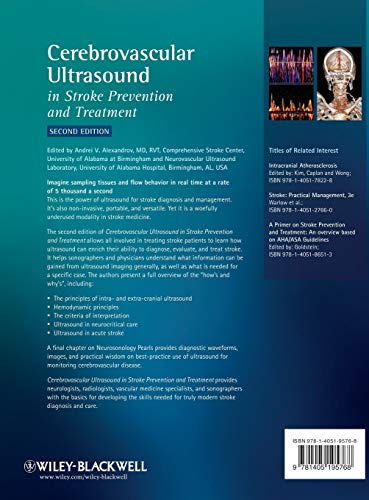 Cerebrovascular Ultrasound in Stroke Prevention and Treatment