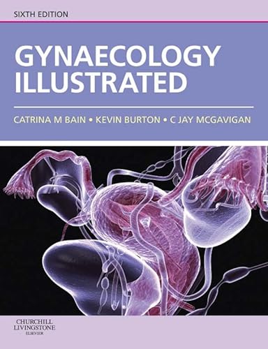 Gynaecology Illustrated: Gynaecology Illustrated E-Book (English Edition)