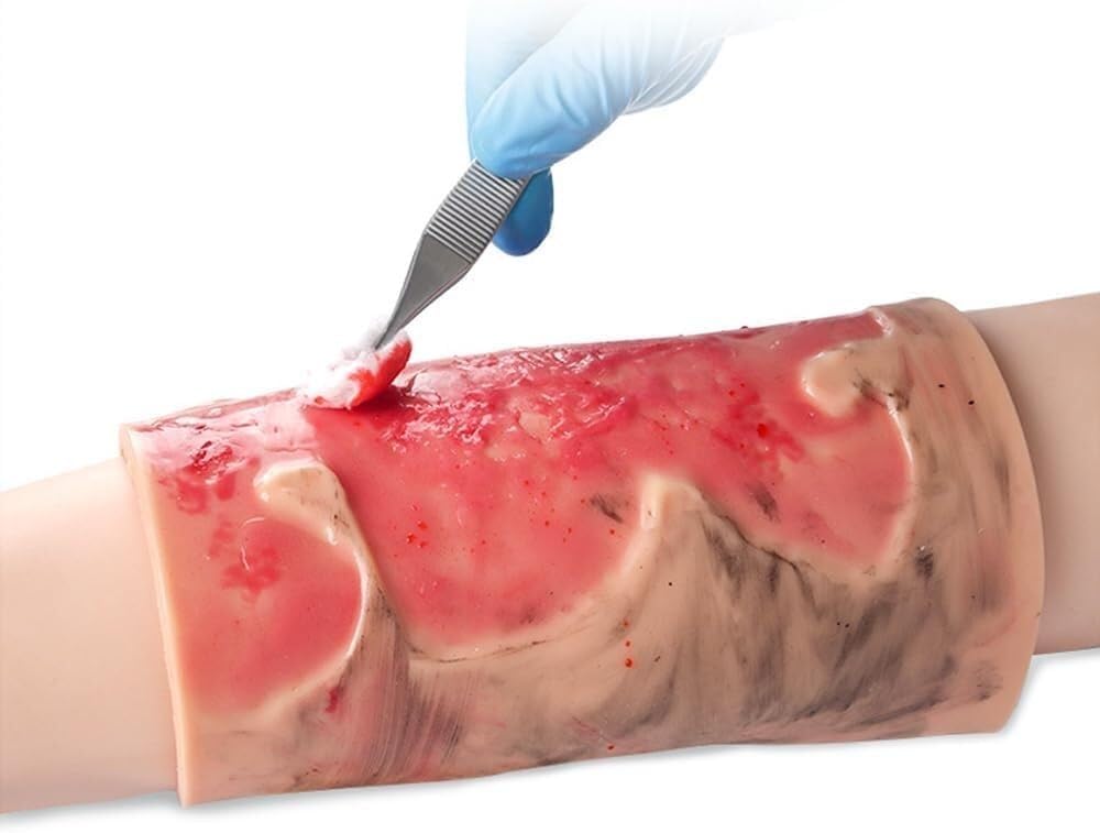 Modello di ferita da ustione, simulatore di ustioni agli arti in silicone indossabile, modulo di formazione for ustioni agli arti di 2-3 gradi for la cura, dimostrazione di insegnamento medico.