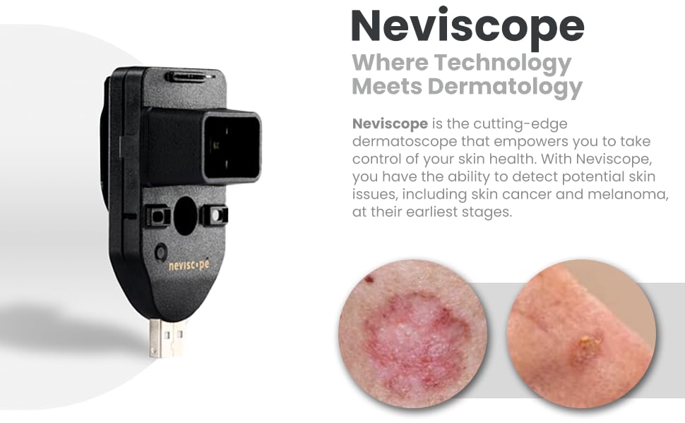 Dermatoscope pour téléphone portable Neviscope microscope polarisé iPhone Android clip universel - 4