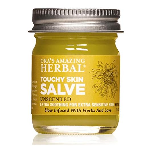 Touchy Skin Salve, Eczema Cream For Adults and Kids, Eczema Treatment, Calendula Cream, Dermatitis, Dry Hands, Calendula Ointment, Healing Ointment, Ora’s Amazing Herbal