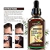 Hair-Growth-Serum-Votala-Hair-Growth-Treatment-Hair-Serum-Anti-Hair-Loss-Thinning-Balding-Repairs-Hair-Follicles-Promotes-Thicker-Stronger-Hair-And-Promotes-Hair-Regrowth Hair Growth Serum, VOTALA Hair Growth Treatment, Anti Hair Loss, Promotes Thicker, Stronger Hair, And Hair Regrowth for Men Women