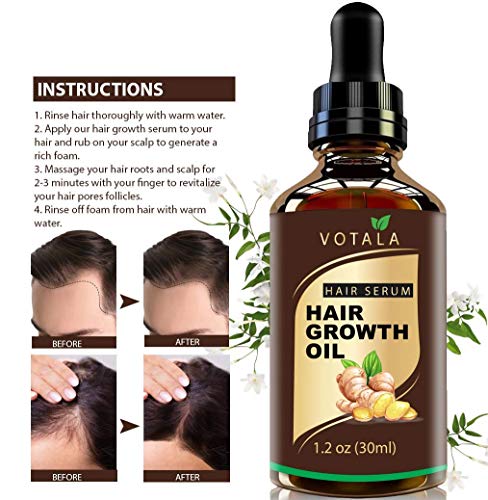 Hair-Growth-Serum-Votala-Hair-Growth-Treatment-Hair-Serum-Anti-Hair-Loss-Thinning-Balding-Repairs-Hair-Follicles-Promotes-Thicker-Stronger-Hair-And-Promotes-Hair-Regrowth Hair Growth Serum, VOTALA Hair Growth Treatment, Anti Hair Loss, Promotes Thicker, Stronger Hair, And Hair Regrowth for Men Women