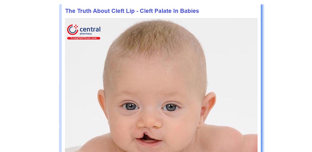 The Truth About Cleft Lip Cleft Palate In BabiesAmazon.deAppstore