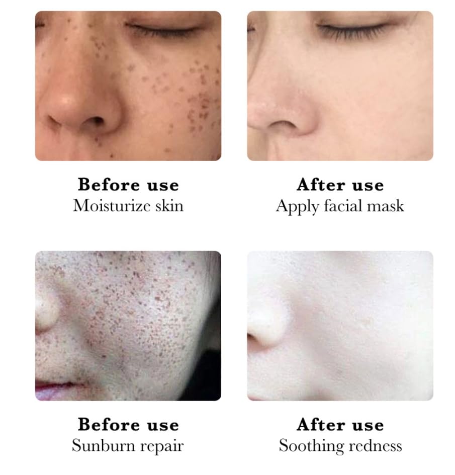 Miniatura 8 de Crema para Manchas Oscuras en La Cara, Esencia de manchas oscuras en la cara, 30ML Vitamina C & E Suero hidratante facial para mujer (1 unidad)