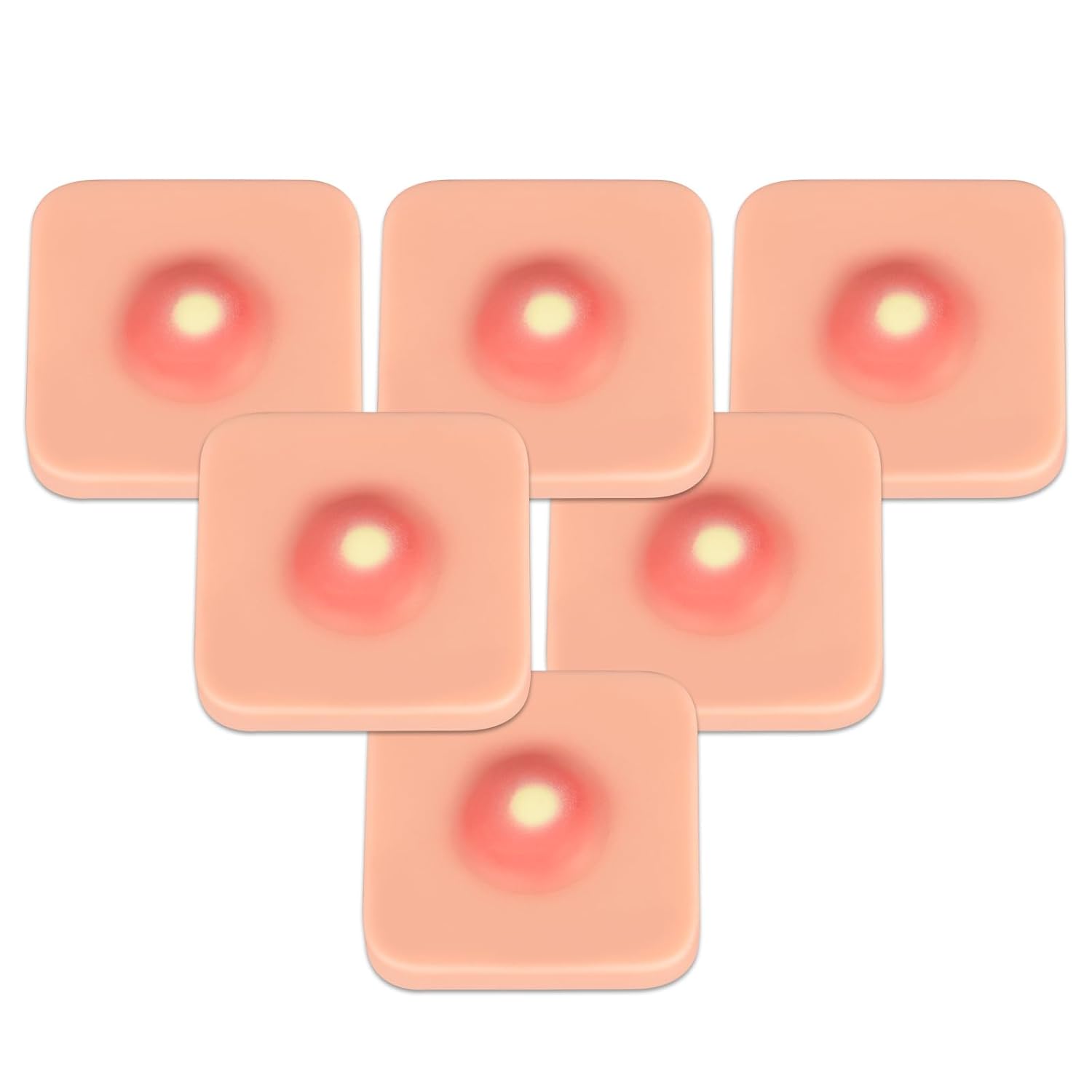 Ultrassist Abscess I&D Incision and Drainage Pad (6Pack), Sebaceous