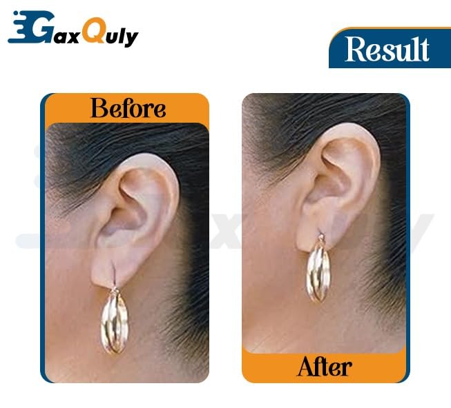 Image of Transparent Ear Lobe for Support Earrings Invisible Heavy Earring Supporter Tapes Stickers Lifts Patches For Girls & Women, Eliminates the Look of Torn or Stretched Piercings (Pack of 40 Patches)