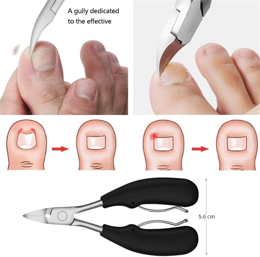 Toenail Clippers – Professional Ingrown Toenail Treatment, Toenail Clippers for Seniors Thick Toenails, Upgraded Clippers for Men,Fingernail Clippers Foot, Hand and Nail Care