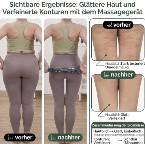 MAHLINÉ Anti-Cellulite Massagegerät mit Trockenbürste – Manuelles Faszienmassage Set für Beine, Po, Bauch & Arme – Hautstraffung & Lymphdrainage – Inklusive Baumwollbeutel