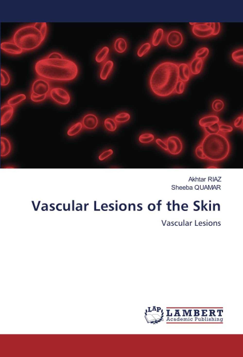Buy Vascular Lesions of the Skin Vascular Lesions Online at desertcartUAE