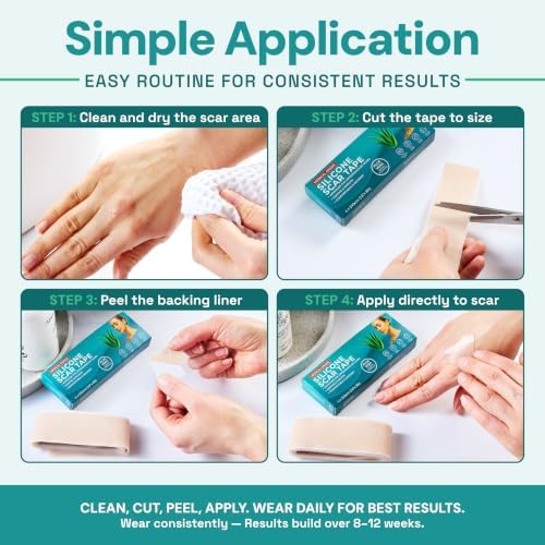 TARGET CONTROL Scar Tape, Scar Sheets & Scar Patches – Silicone Scar Patches for Surgical Scars, C-Section Silicone Strips, Medical Grade Aloe Vera Scar Tape for Face and Body — view 4