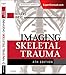 Imaging Skeletal Trauma