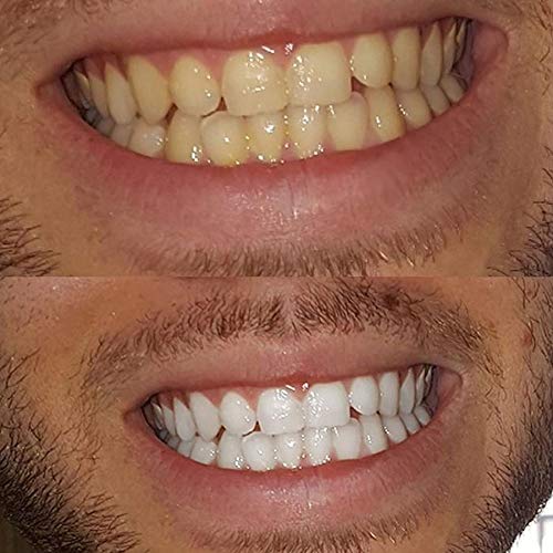 Branqueador de Dentes em Pó Carvão Ativado Profissional Natural Bambu - Higiene Oral e Limpeza das P