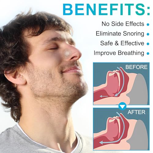 Image of 90 Pcs Nose Strips for Breathing, Nasal Strips for Breathing, Snoring Stopper for Men and Women, Nostril Opener, for Night Use to Reduce Snoring and Improve Breathing During Colds