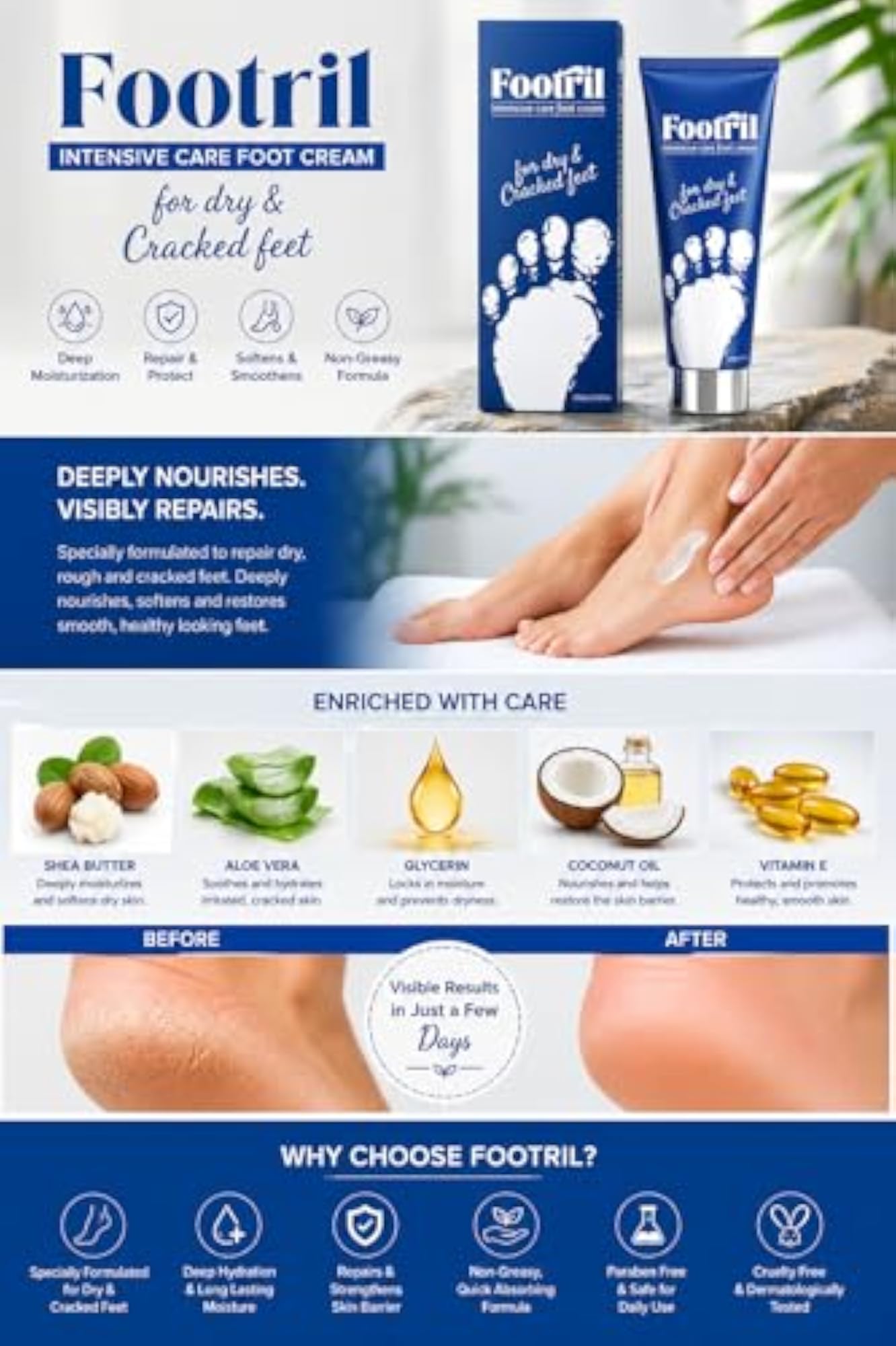Footril Intensive Care Foot Cream for Dry and Cracked Feet