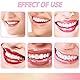 OHSN Zahn Edelstein Set 10 pcs DIY Zahn Edelstein Kit Zahnstein Schmuck Zahnschmuck set Mit Kleber Für Zähne Teeth Gems Kit für Reflektierende Zahnverzierungs-Dekoration Mit 1445 pcs Tooth Gem