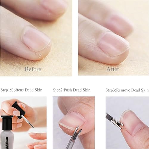 Miniatura 4 de Empujador de cutículas de uñas inoxidables, cortador de tijeras, removedor de tijeras, limpiador de uñas de piel muerta, eliminación de callos de