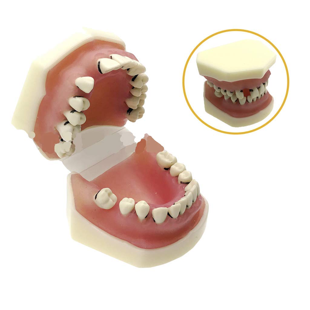 Modello Didattico di Denti Standard Ortodontici per Studenti di Odontoiatria Infantile, Modello Anatomico Dentale, Modello Dimostrativo Dentale