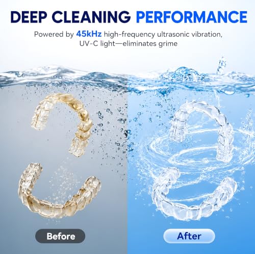 Image of Ultrasonic Retainer Cleaner Machine 45kHz, Dental Ultrasonic Care Cleaner | Ultrasonic Dental Pod For Dentures, Aligners, Mouth Guards, Night Guards, Toothbrush Heads & Jewelry with 200ML Capacity
