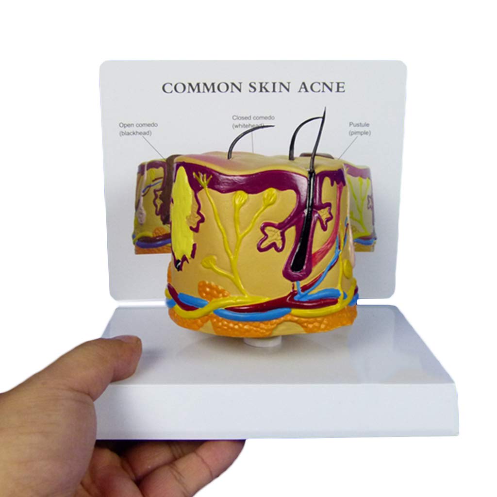 Buy LUCKFY Skin Model,Hair Follicle Hair Anatomy Model Acne pustule