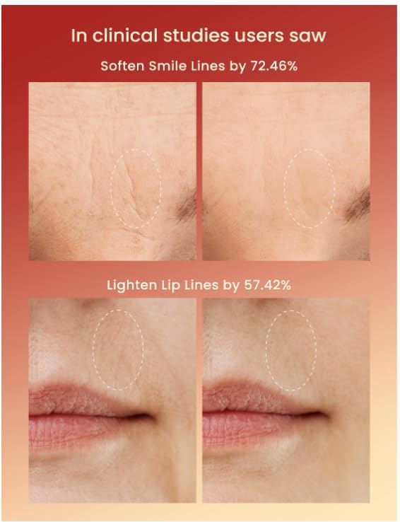 Red Light therapy Mask for Face Wrinkles,Silicone Portable Led Facial Mask Light Therapy for Full Face Even Skin Tone,Fine Lines&Wrinkles,10- Min Treatment,Wired - Image 3