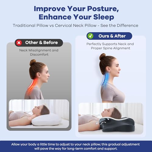 Image of Cervical Neck Pillow for Pain Relief,Cervical Pillow with Memory Foam Ergonomic Pillows with Dual Heights for Back,Stomach and Side Sleepers Kids' Floor Pillows Cushions (Grey, Standard 26 inchx15 inch)