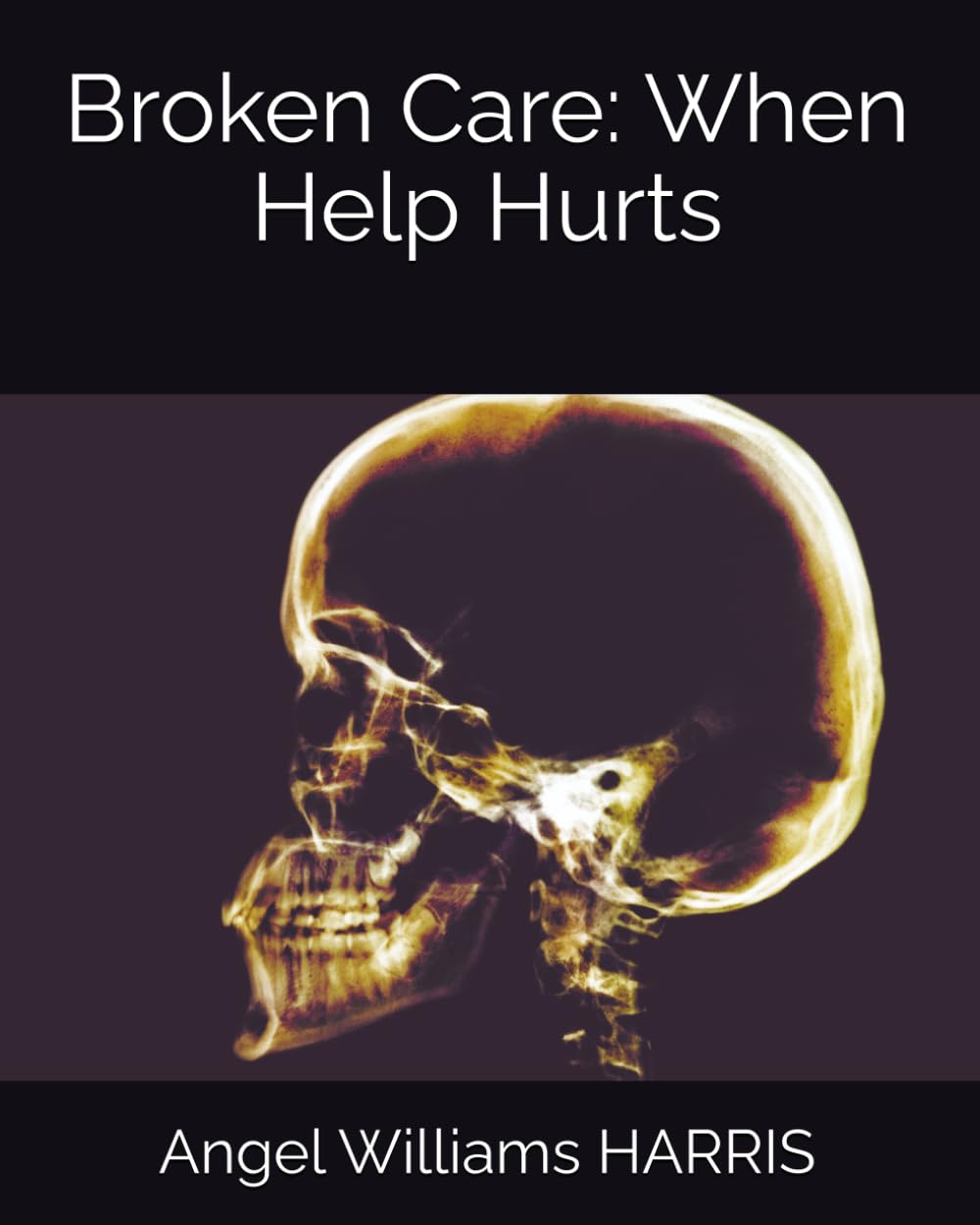 Broken Care: When Help Hurts