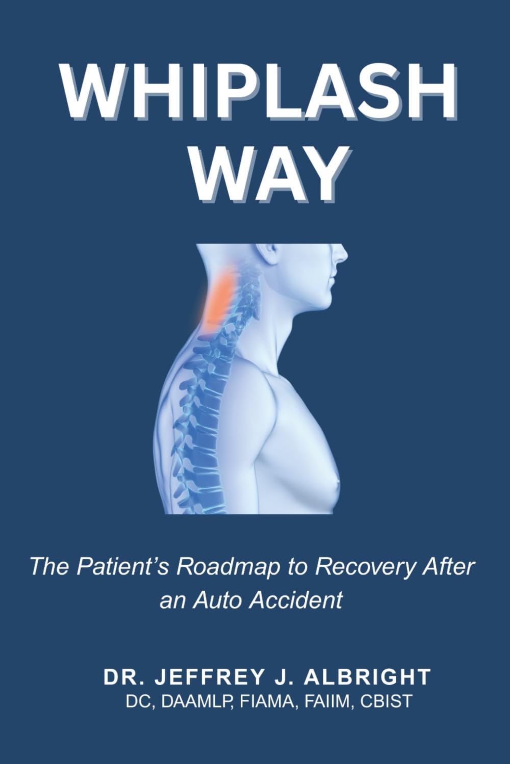 The Whiplash Way: The Patient’s Roadmap to Recovery After an Auto Accident
