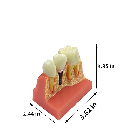 Miniatura 21 de 2 modelos de dientes estándar, modelo dental para adultos, modelo estándar de demostración de Typodont para niños, enseñanza dental, pantalla