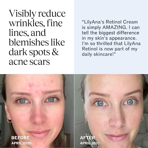 LilyAna Naturals Retinol Cream - Made in USA, Anti Aging Moisturizer for Face and Neck,Wrinkle, Retinol Complex - 1.7oz - Image 4