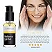 YEOUTH Under Eye Gel with Hyaluronic Acid for Puffiness, Under Eye Bags & Circles, Hydrating Skincare for Tired-Looking Eyes 1oz