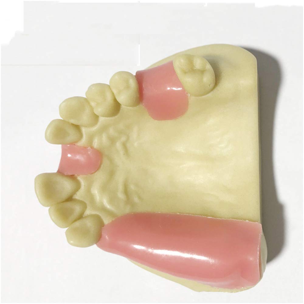 Sjdopulse A Teeth Teaching Model Maxillary Missing Tooth Model - Soft Gums Can Be Sutured Exercises - Rtificial Bone Dental Teeth Study Teaching Model - For Dental Teaching Training Implant Practice ( )
