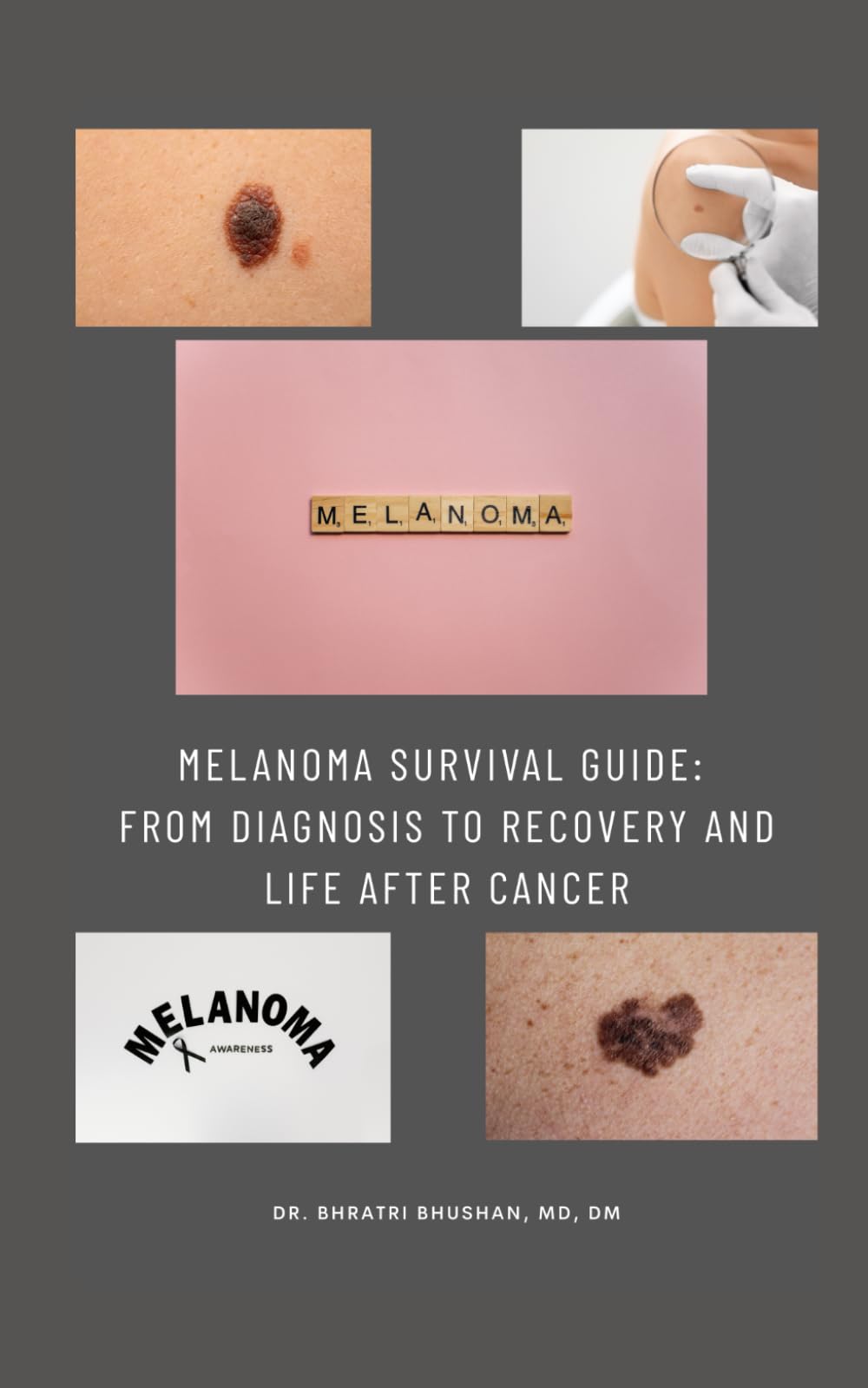 Melanoma Survival Guide: From Diagnosis to Recovery and Life After Cancer