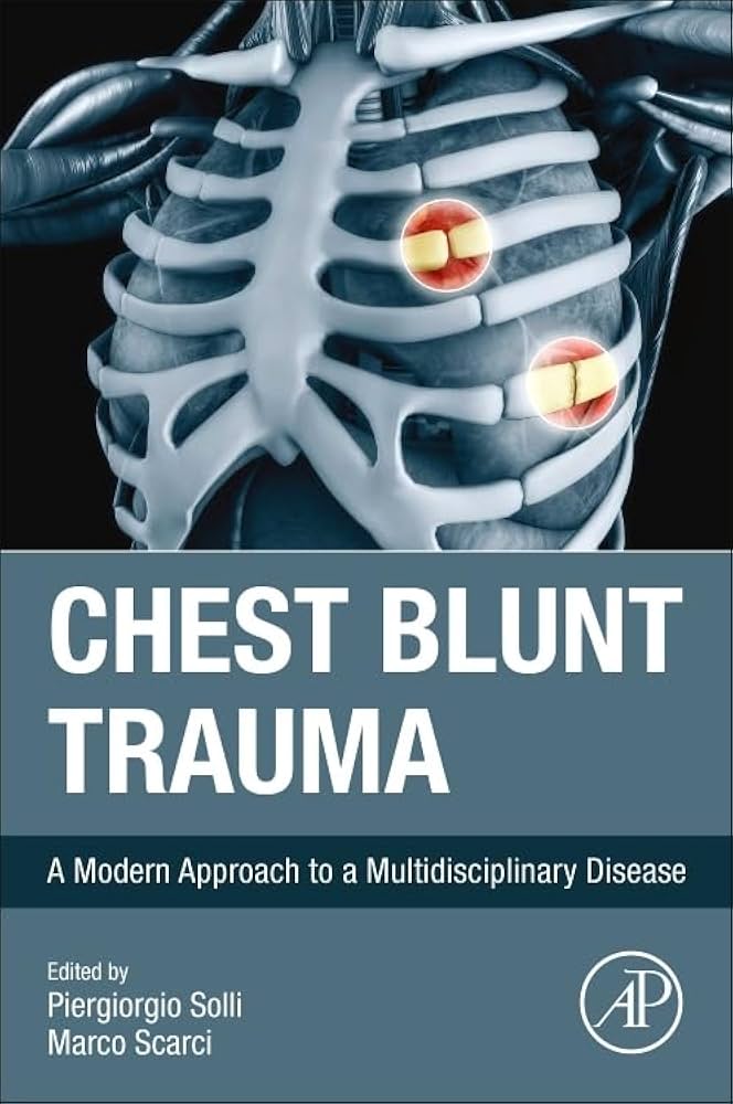 Amazon.com: Chest Blunt Trauma: A Modern Approach to a