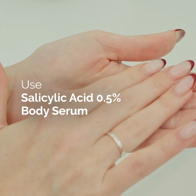 Image of The Ordinary Salicylic Acid 0.5% Body Serum, Exfoliating Treatment for Acne-Prone Skin, 8.1 Fl Oz