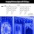 Led Christmas Lights Outdoor Christmas Decorations Hanging Lights 400LED 8 Modes 75 Drops, Waterproof Outdoor Indoor Fairy Christmas Light for Party, Holiday, Wedding, Eaves Decorations (Blue)