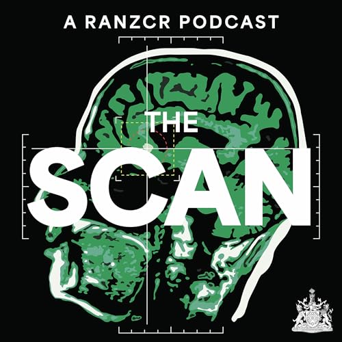 The Scan copertina
