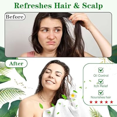 Shampoo Caps No Rinse, 12 Pack Waterless Shampoo Caps for Bedridden Patients and Elderly, Rinse Free Hair Washing Shower Caps for Post Surgery, Hospital, Camping