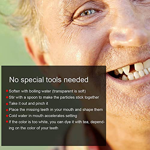 Kit di riparazione dei denti, Kit di riparazione