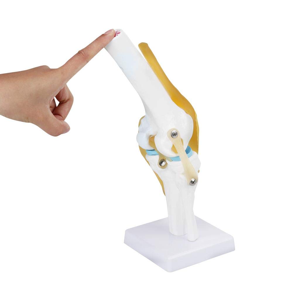 Skelett Anatomie Lebensgroß Anatomisches Kniegelenk Mit Bändern Modell,32CM Skelett Anatomie Wirbelsäule Knochenmodell Medizinisches Kniegelenk Osteoporose Anatomisches Modell Für Hobbyisten