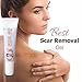 Scar go 15gm scar removal gel for keloids, burn scars, sports injuries scars, acne scars and irregular skin (pack of 2)